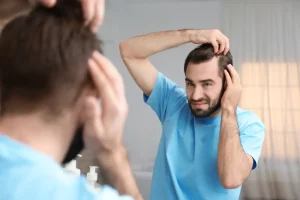 Hairloss Treatment in Doral, Fl - FaceBeauty Med Spa