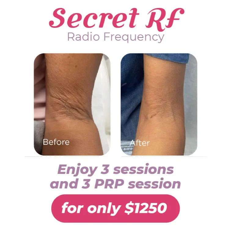 Medical Spa Laser Hair Removal in Doral FaceBeauty Med Spa