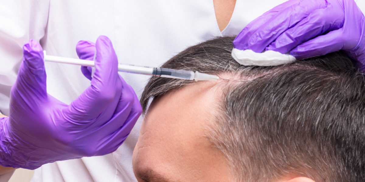 PRP Hair Loss Treatment in Doral FL
